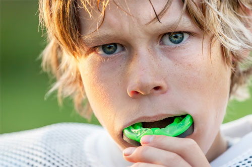 Santa Bringing Your Kids Sports Gear? They’ll Need Mouthguards Too