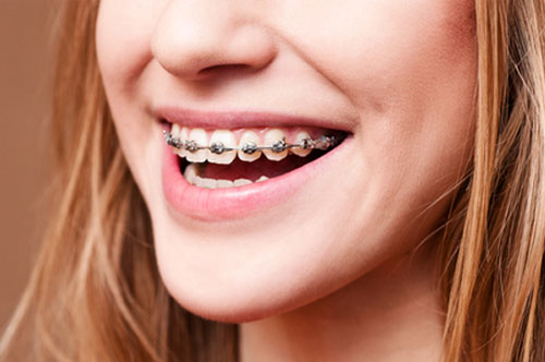 5 Reasons to Let Us Handle Your Child’s Orthodontic Treatment